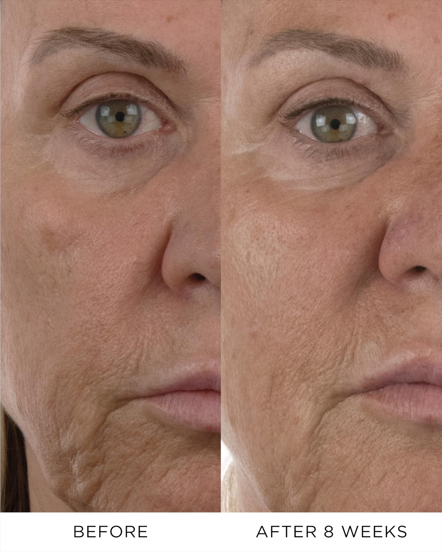 Noble Panacea, The Absolute Intense Renewal Serum, 30 Dose